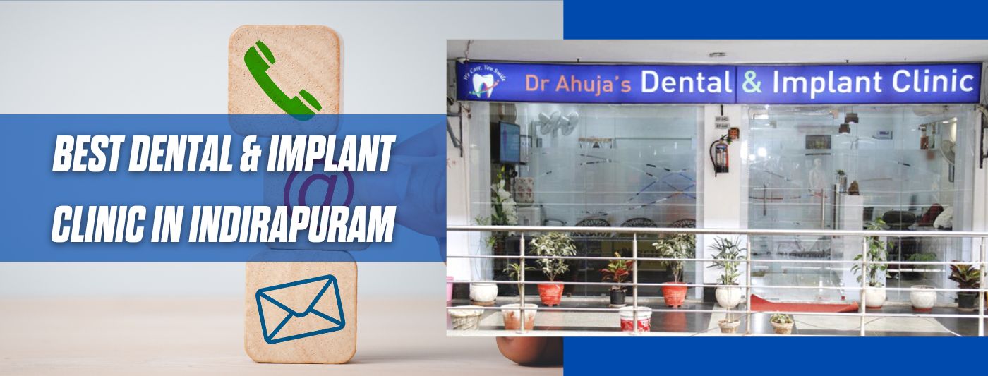 Contact Best Advanced Dental and Implant Clinic in Indirapuram Ghaziabad Noida Delhi NCR Dr. Ahuja 1