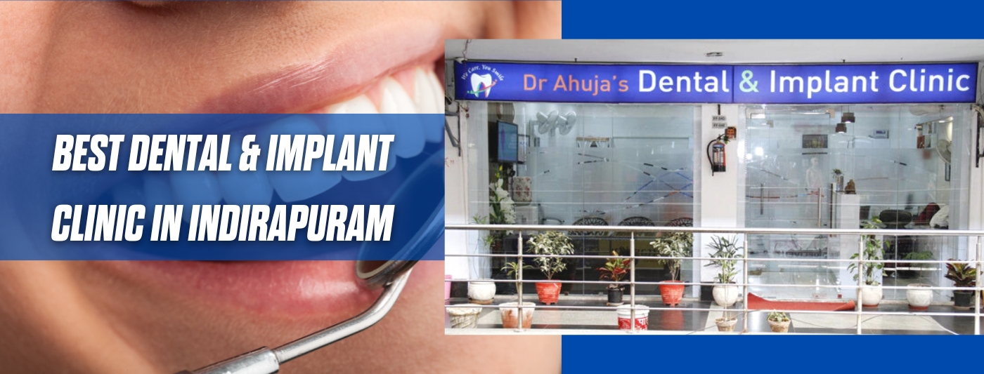 Dr Ahuja Dental and Implant Clinic in Indirapuram Ghaziabad UP India FB Page Cover