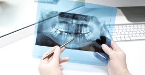 Radiology Services Dr Ahuja Dental and Implant Clinic Indirapuram Vaishali Vasundhara Ghaziabad Noida Delhi NCR